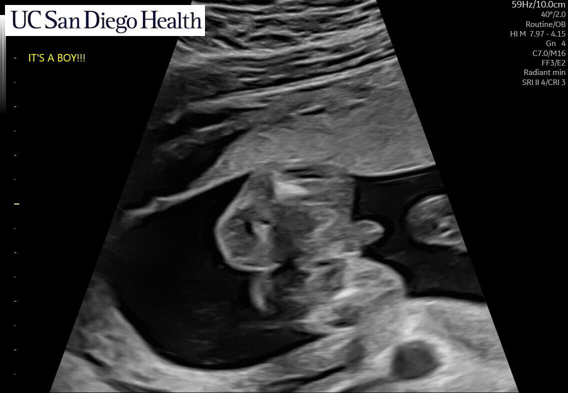 It’s a boy!